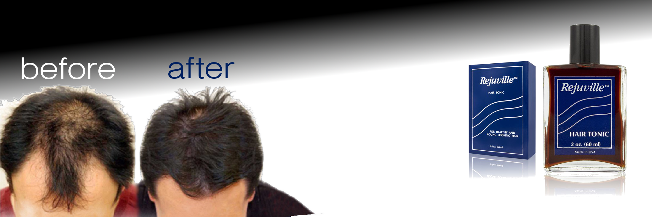 REJUVILLE HAIR TONIC